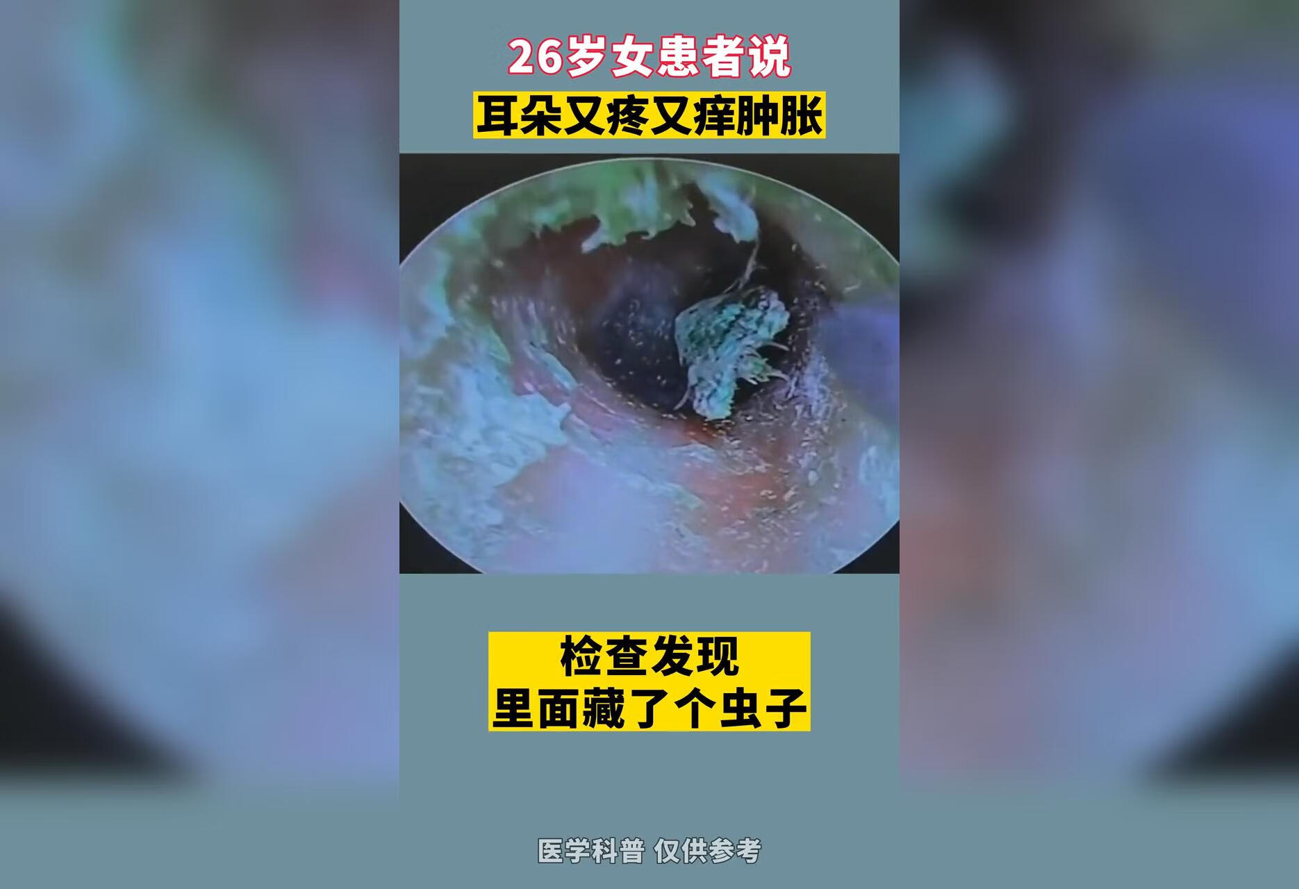 耳如有身体不适及时就医   