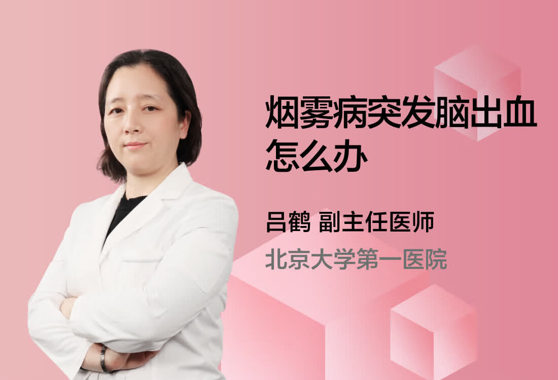 烟雾病突发脑出血怎么办？