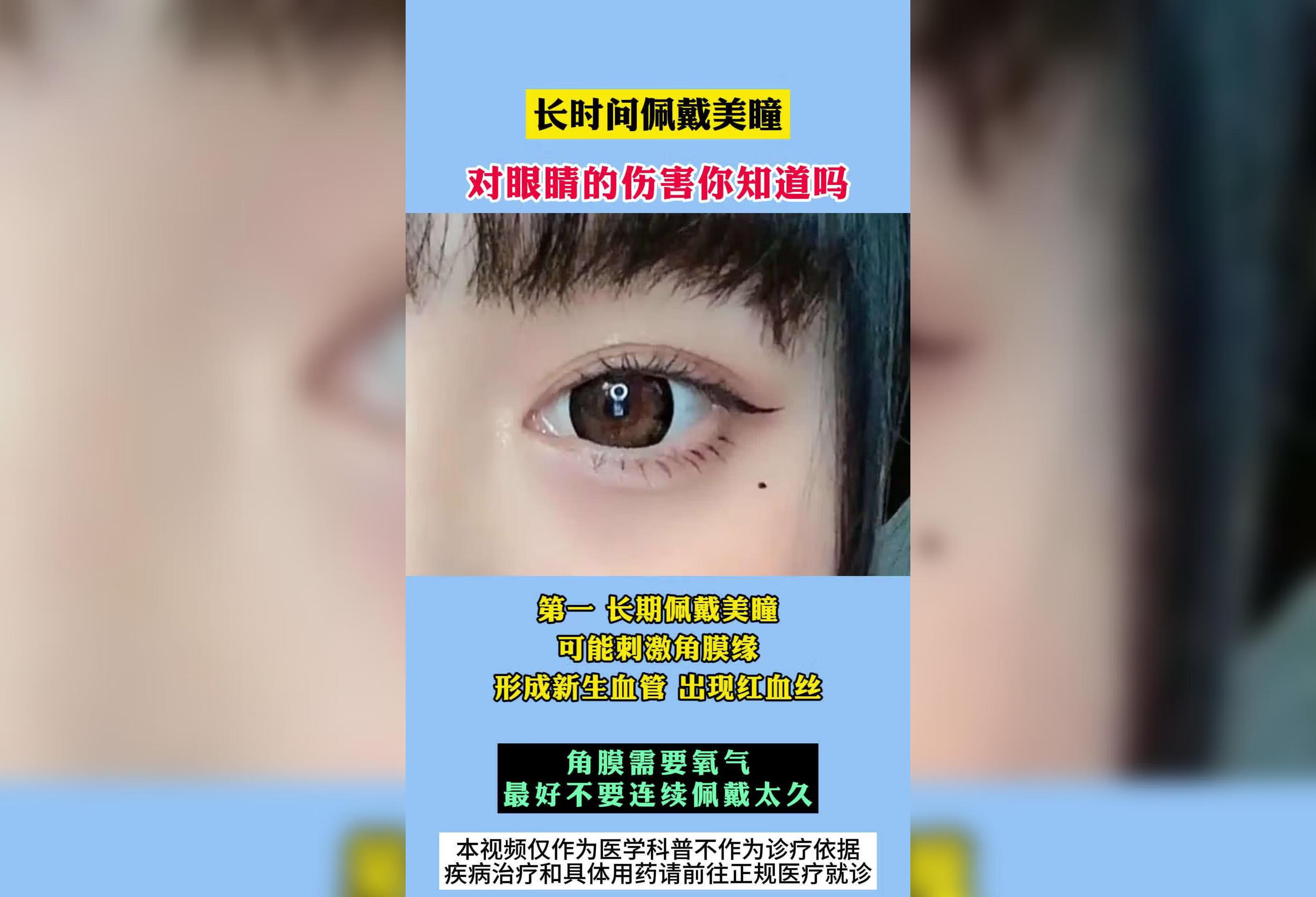 长时间佩戴美瞳对眼睛的伤害，你知道吗？