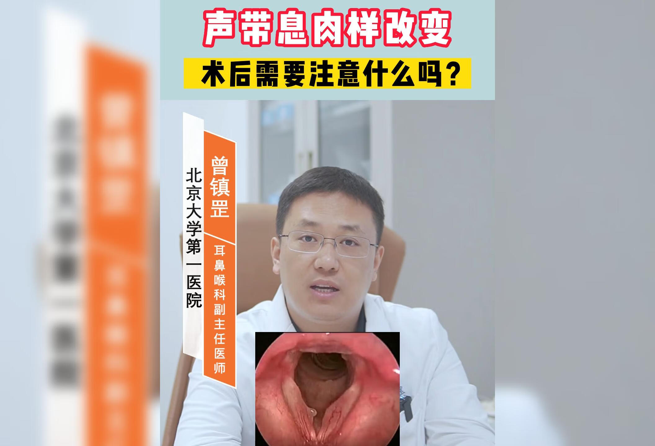 声带息肉样改变，术后需要注意什么吗？