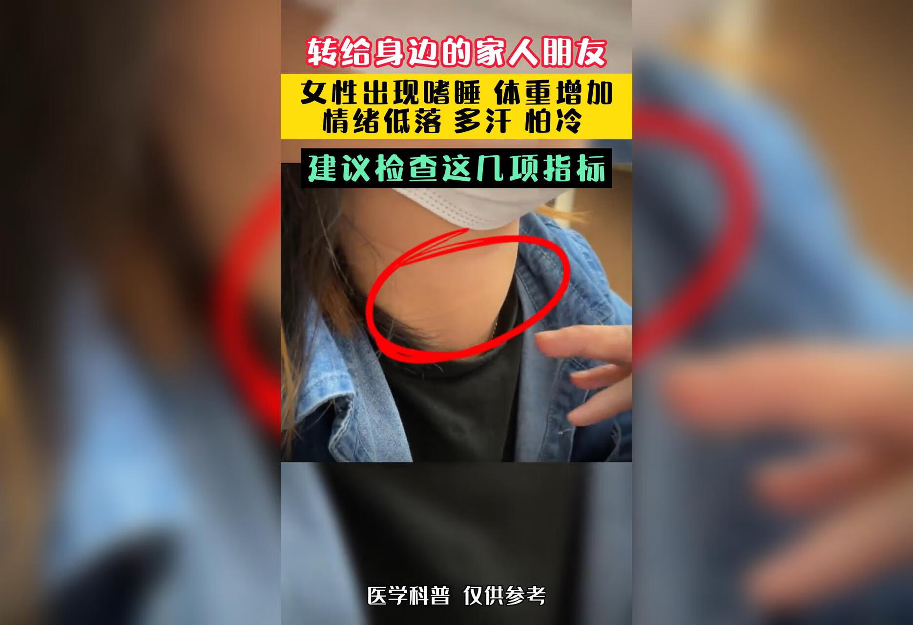  女性出现怕冷，嗜睡，体重增加等情况，建议检查一下这几项指标