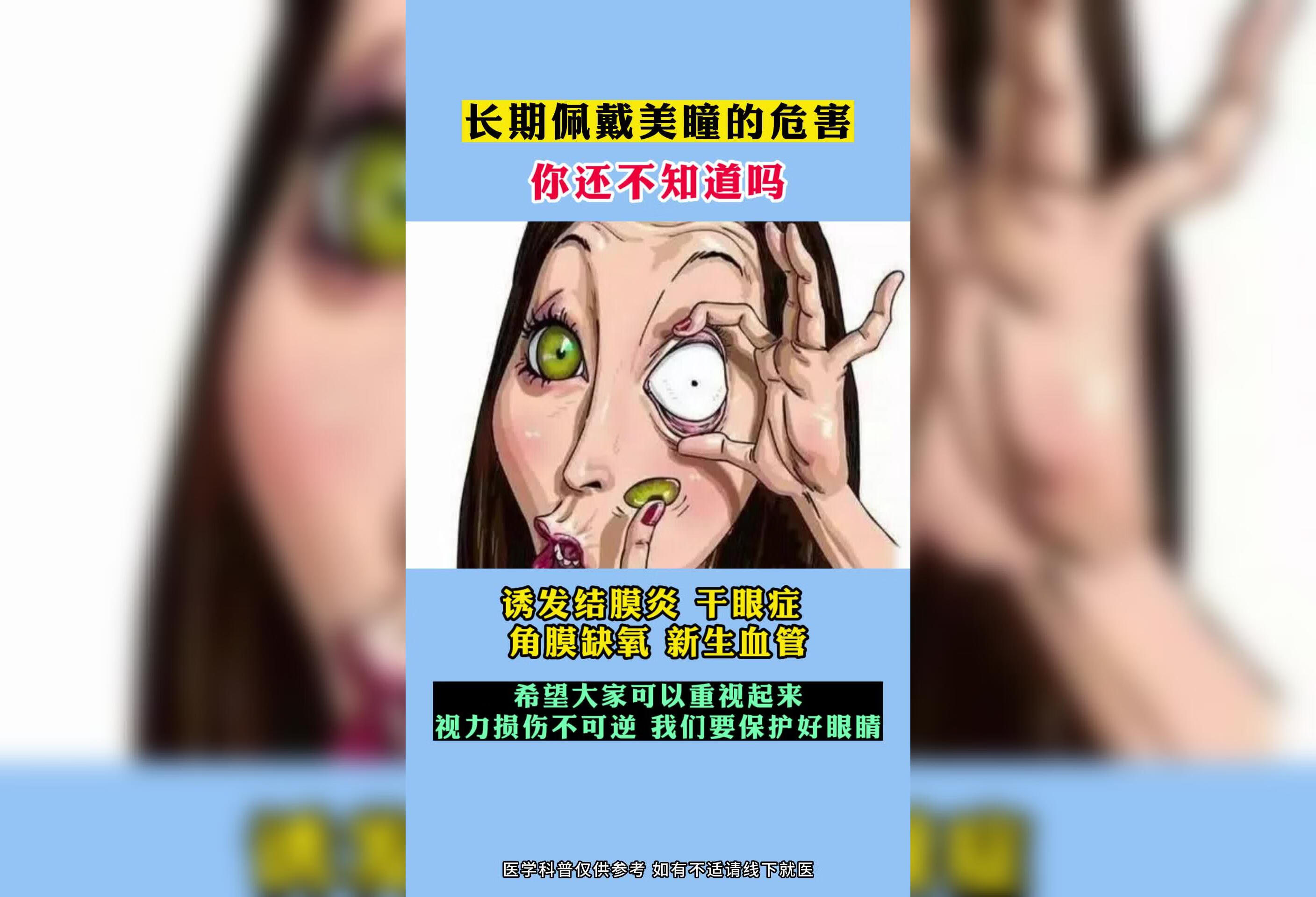 长期佩戴美瞳的危害