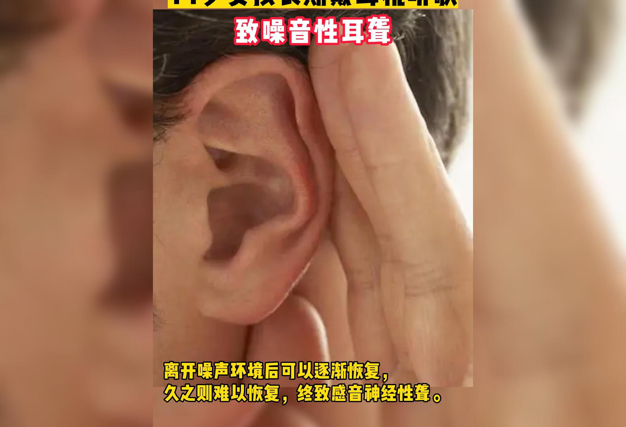 戴耳机听歌导致噪音性耳聋，你一定要注意