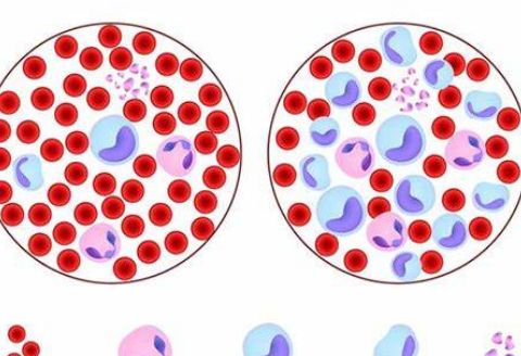 令人闻之色变的白血病，到底是种什么病？