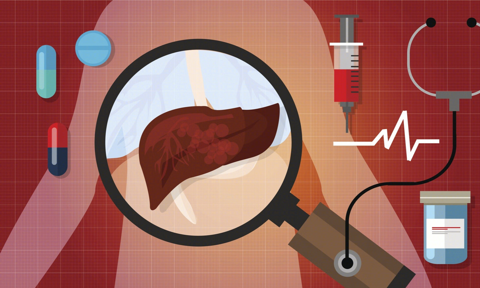 老人一入院就进了ICU，家属质疑，医生为什么迟迟不给做手术