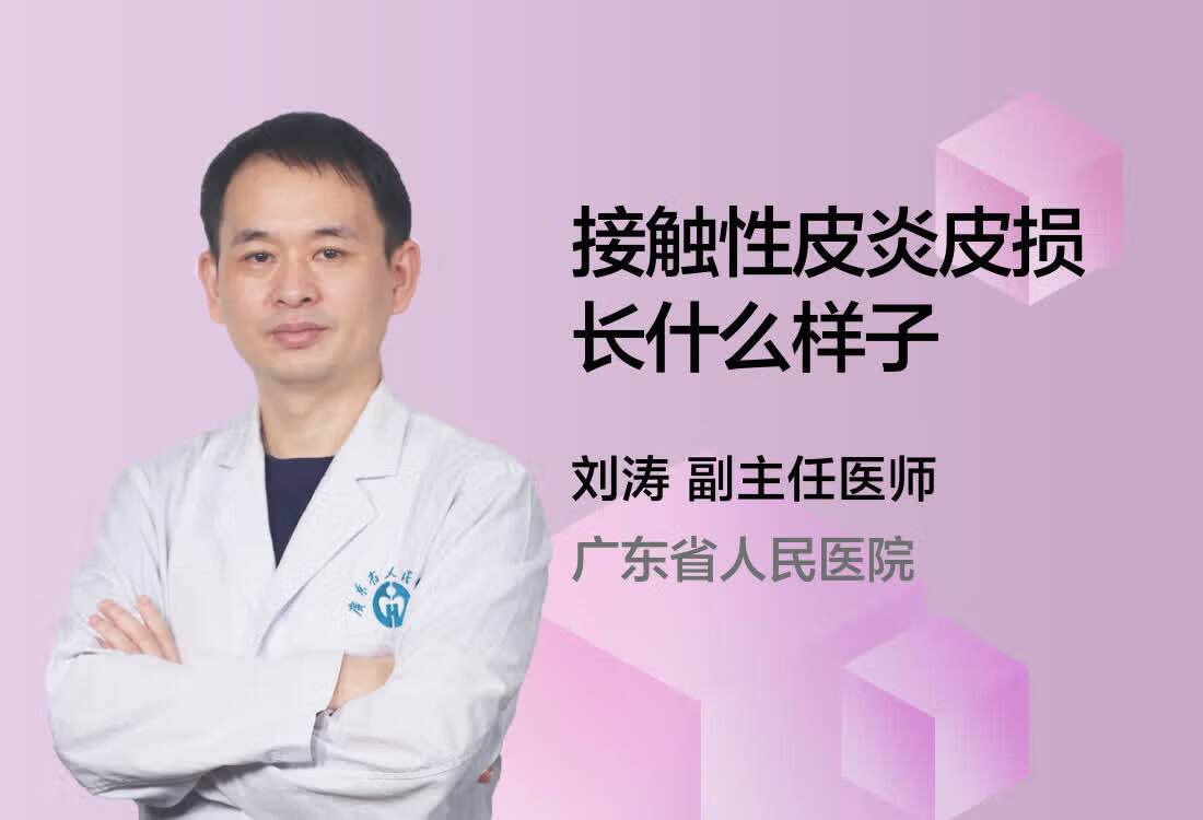 接触性皮炎皮损长什么样子？