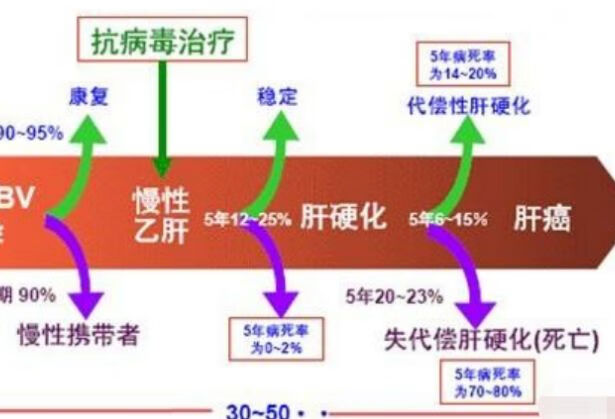 得乙肝的人的寿命短吗？你怎么看？