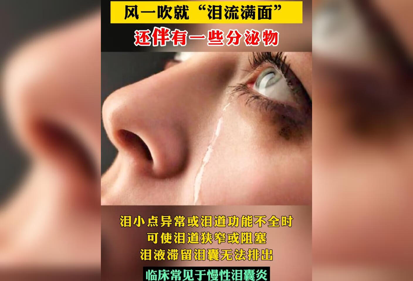 迎风流泪是怎么回事