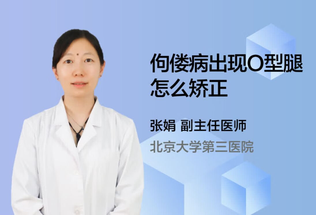 佝偻病出现O型腿怎么矫正?