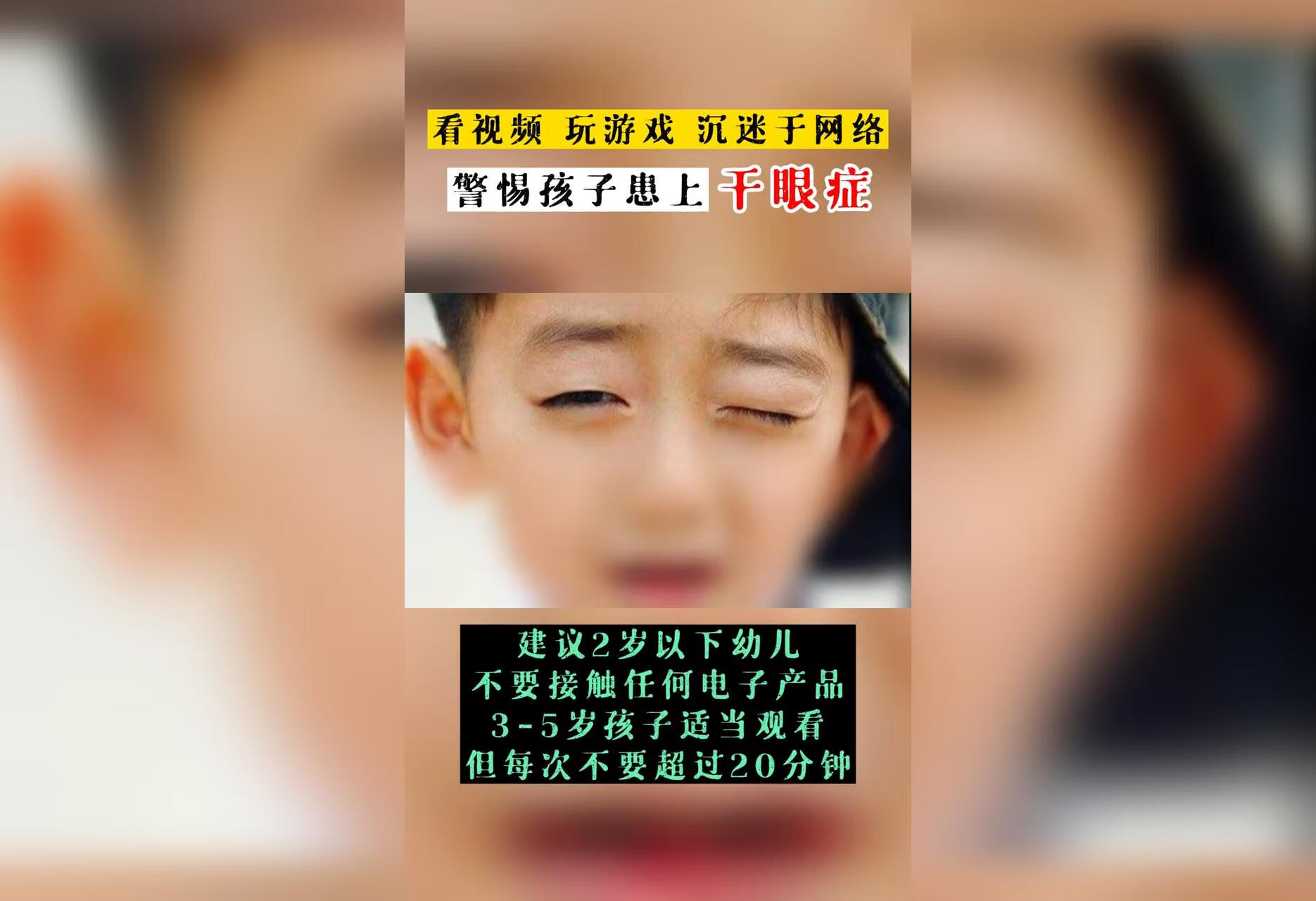 警惕孩子患上干眼症