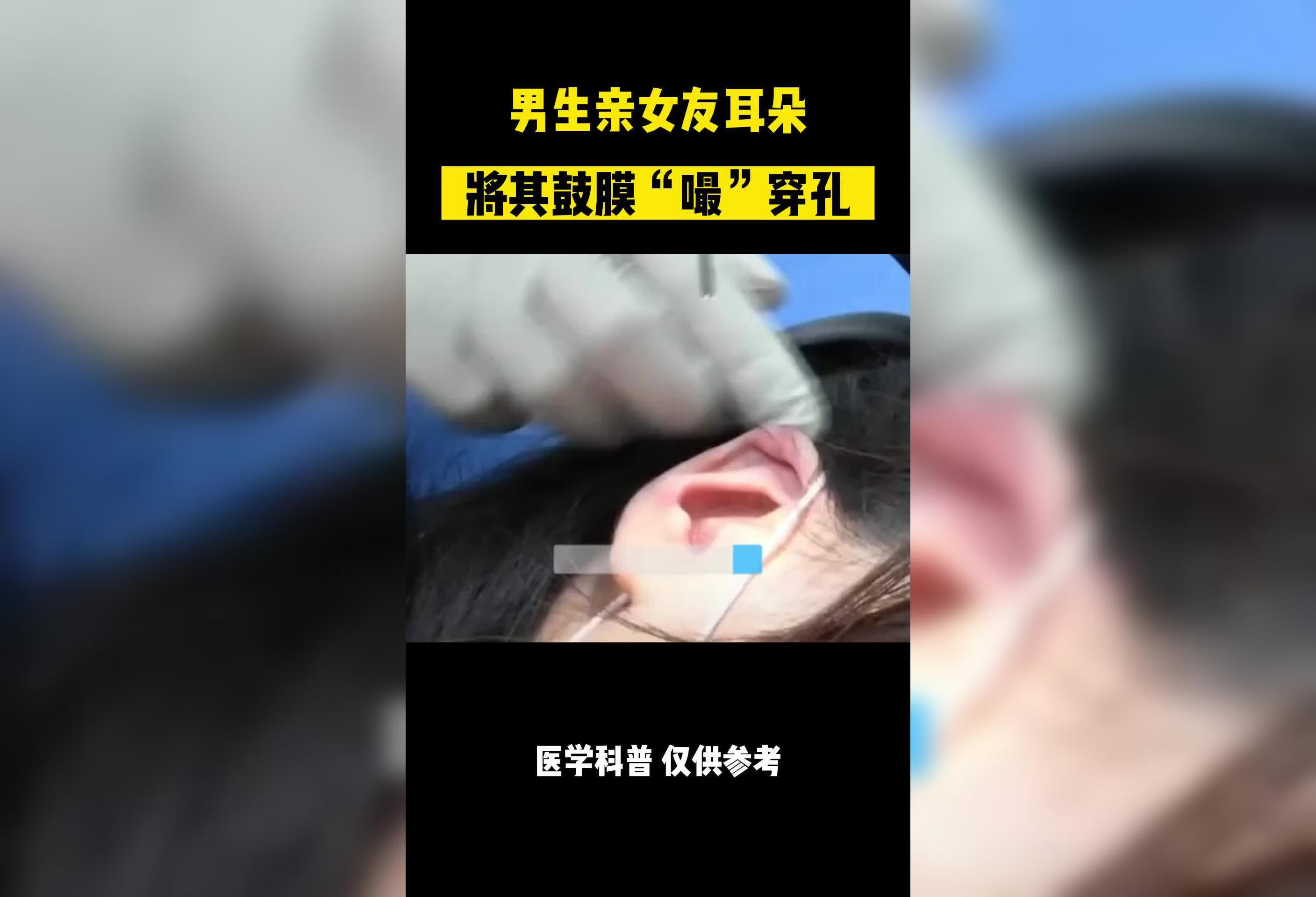 男生亲女友耳朵，导致其鼓膜穿孔