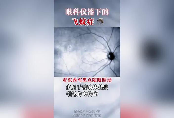 飞蚊症一定要到眼科检查是生理性还是病理性