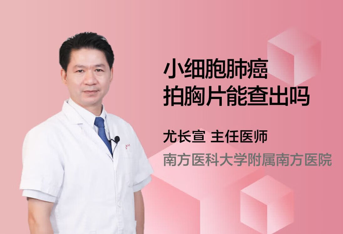 小细胞肺癌拍胸片能查出吗？