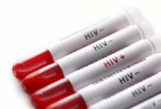 歧视、污名......感染HIV后的第100天，世界与我背道而驰