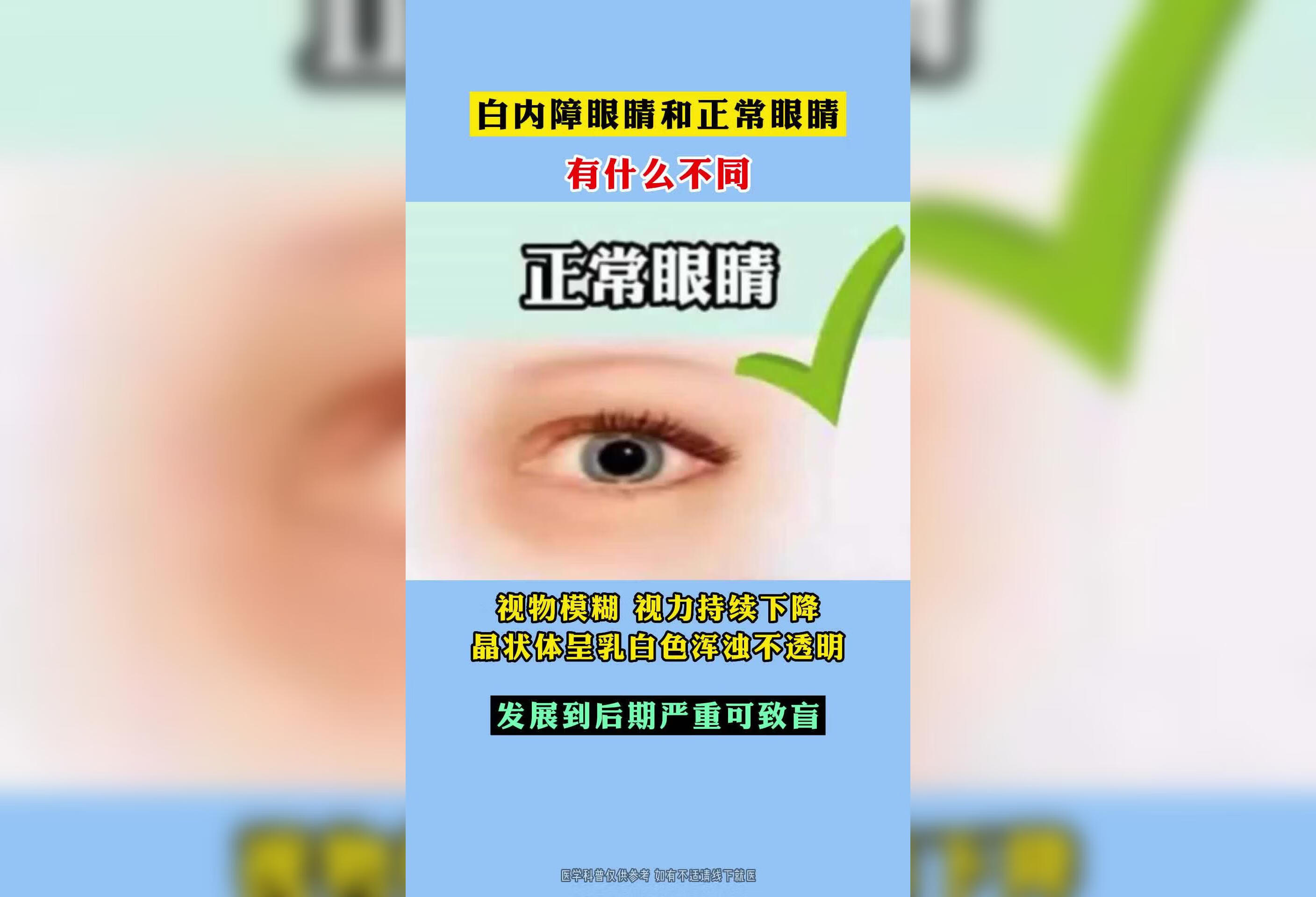 白内障眼睛和正常眼睛有什么不同？