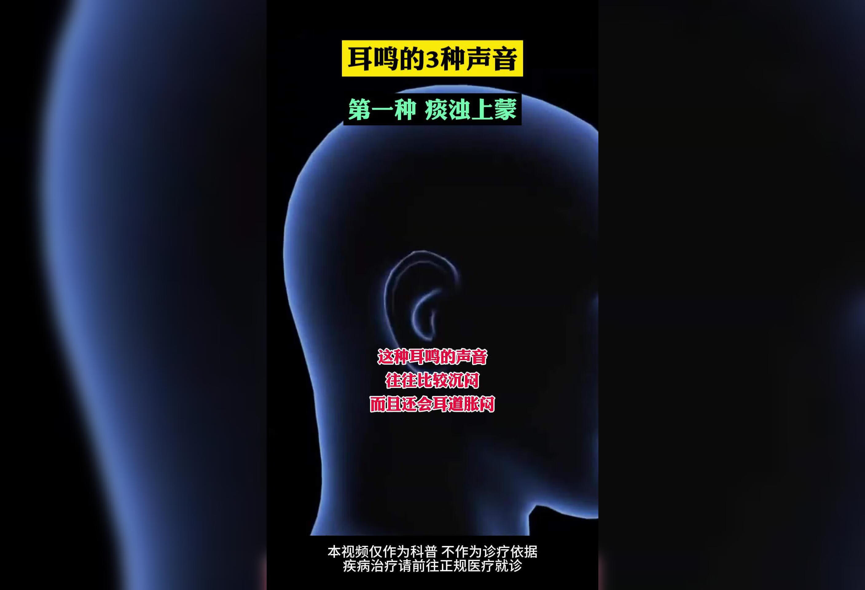 耳鸣的3种声音，你的是哪种呢？