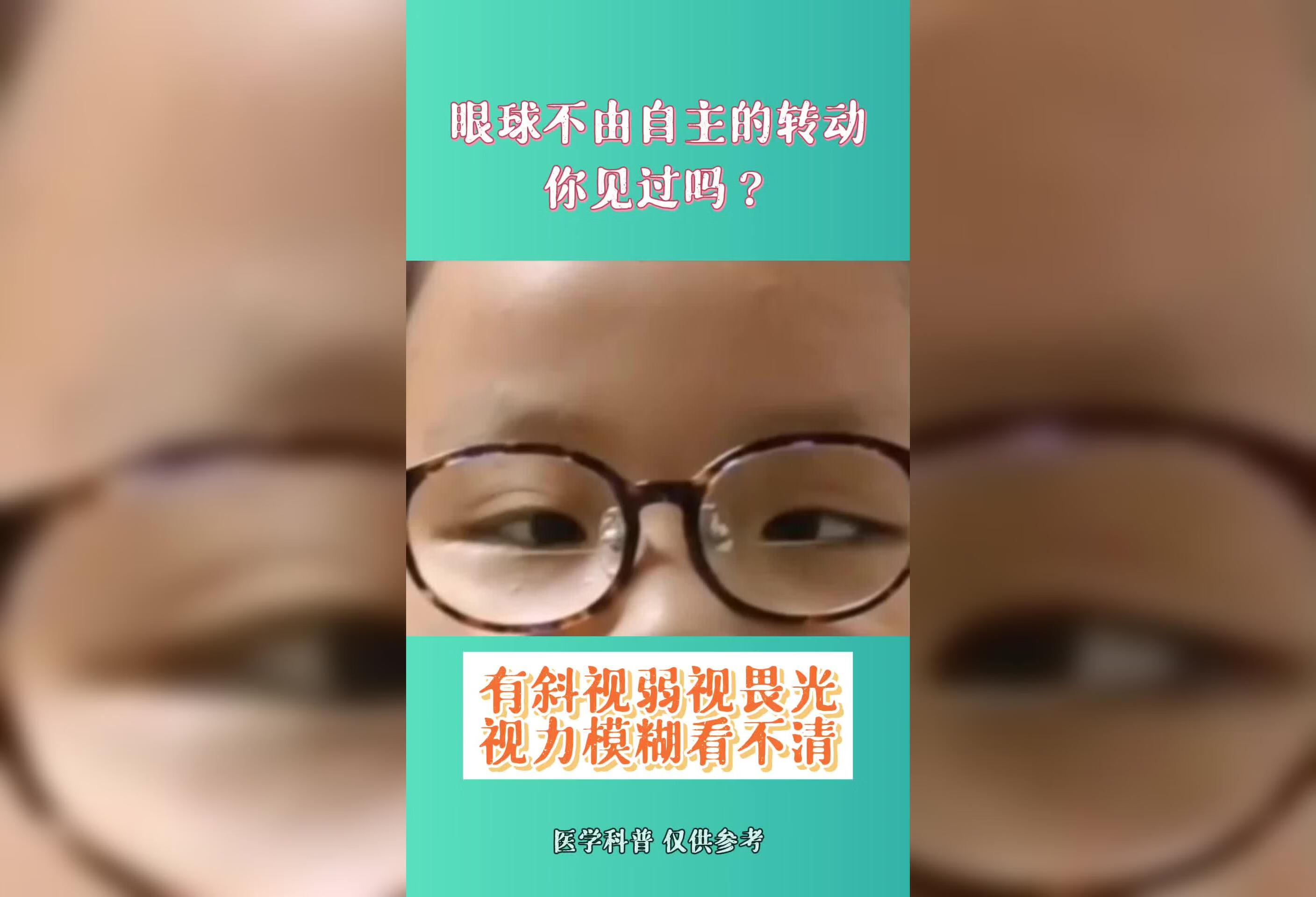 眼球不由自主的转动，你见过吗？