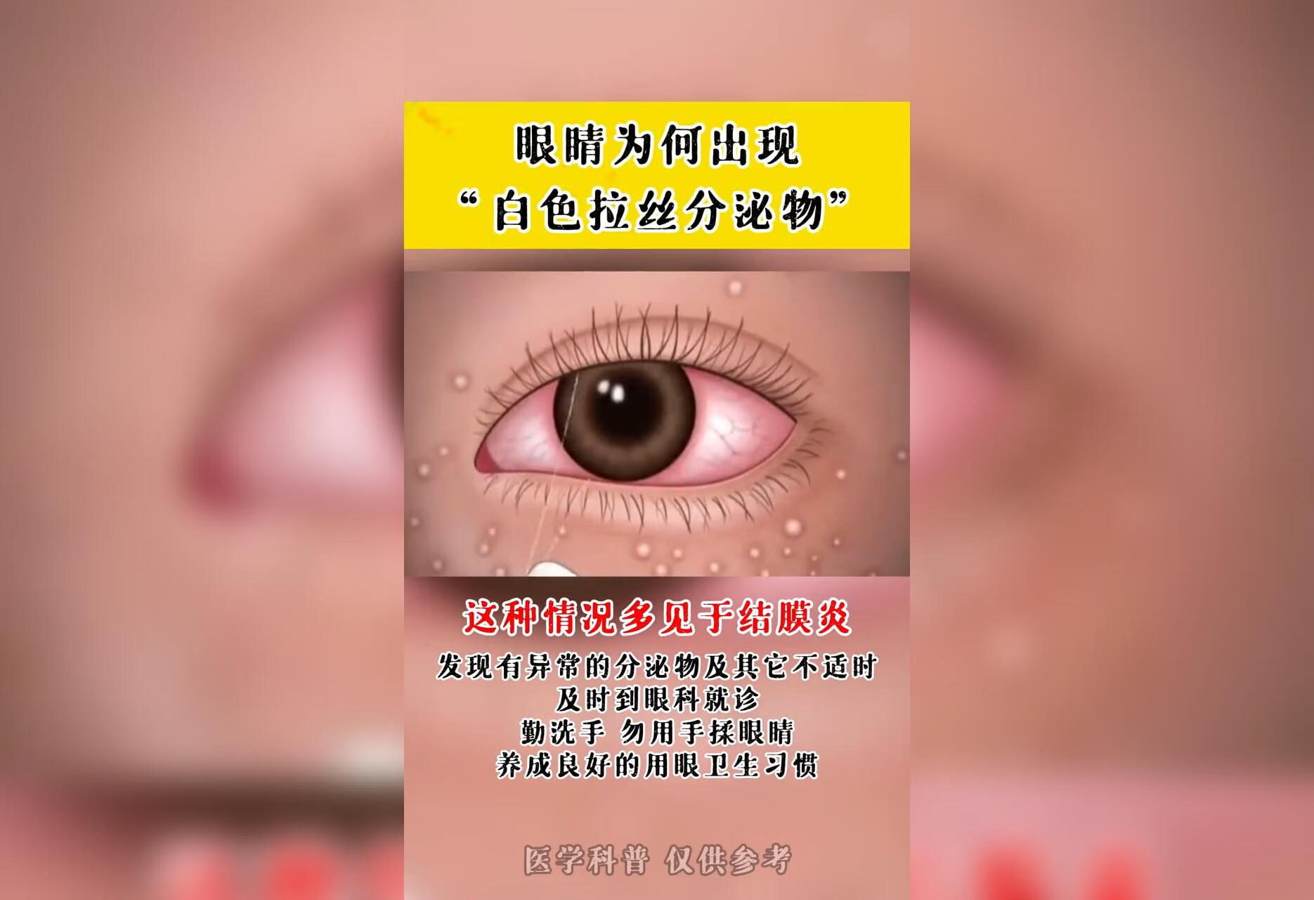 要养成良好的用眼卫生习惯