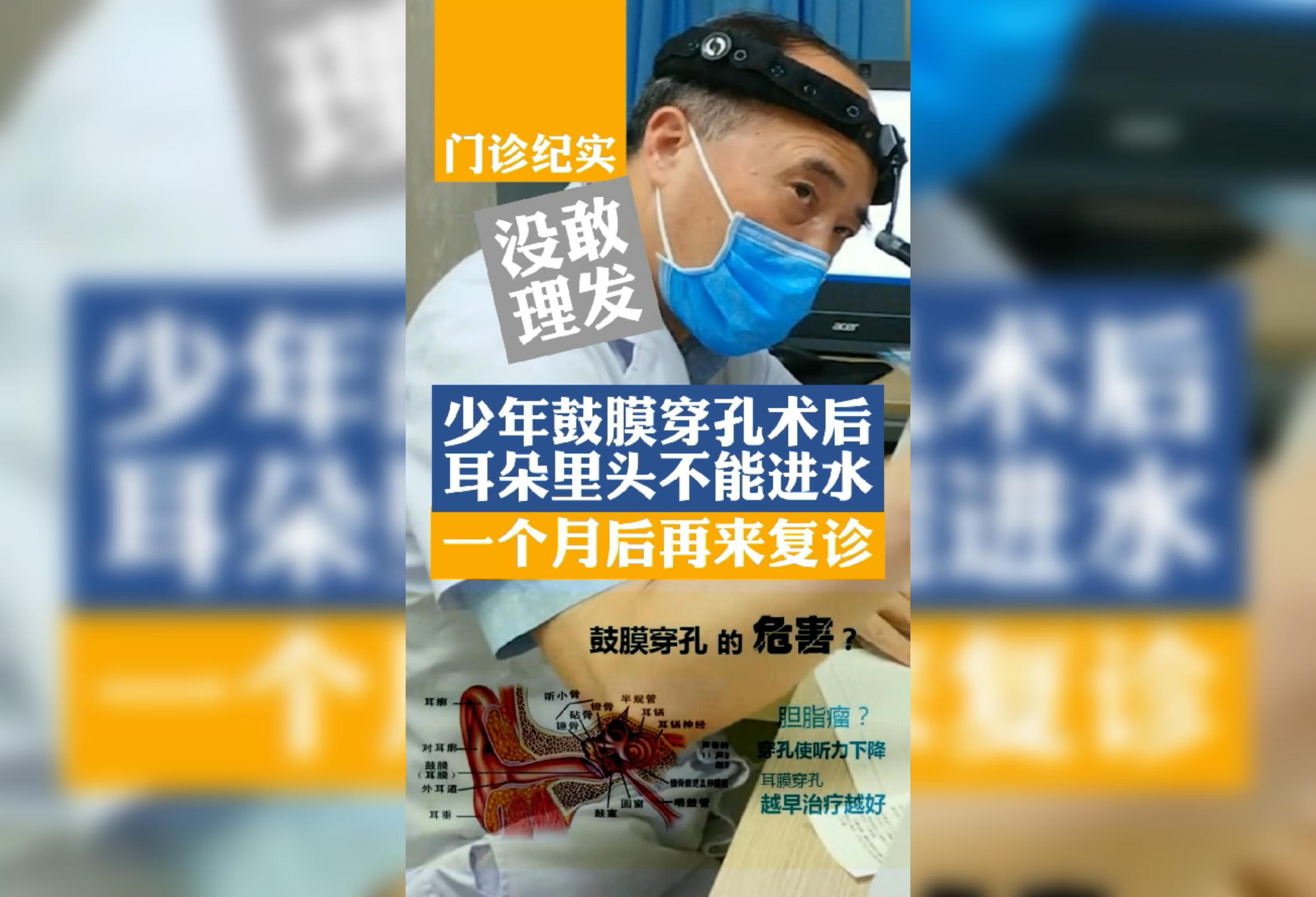 鼓膜穿孔术后恢复期要注意耳朵里面不要进水