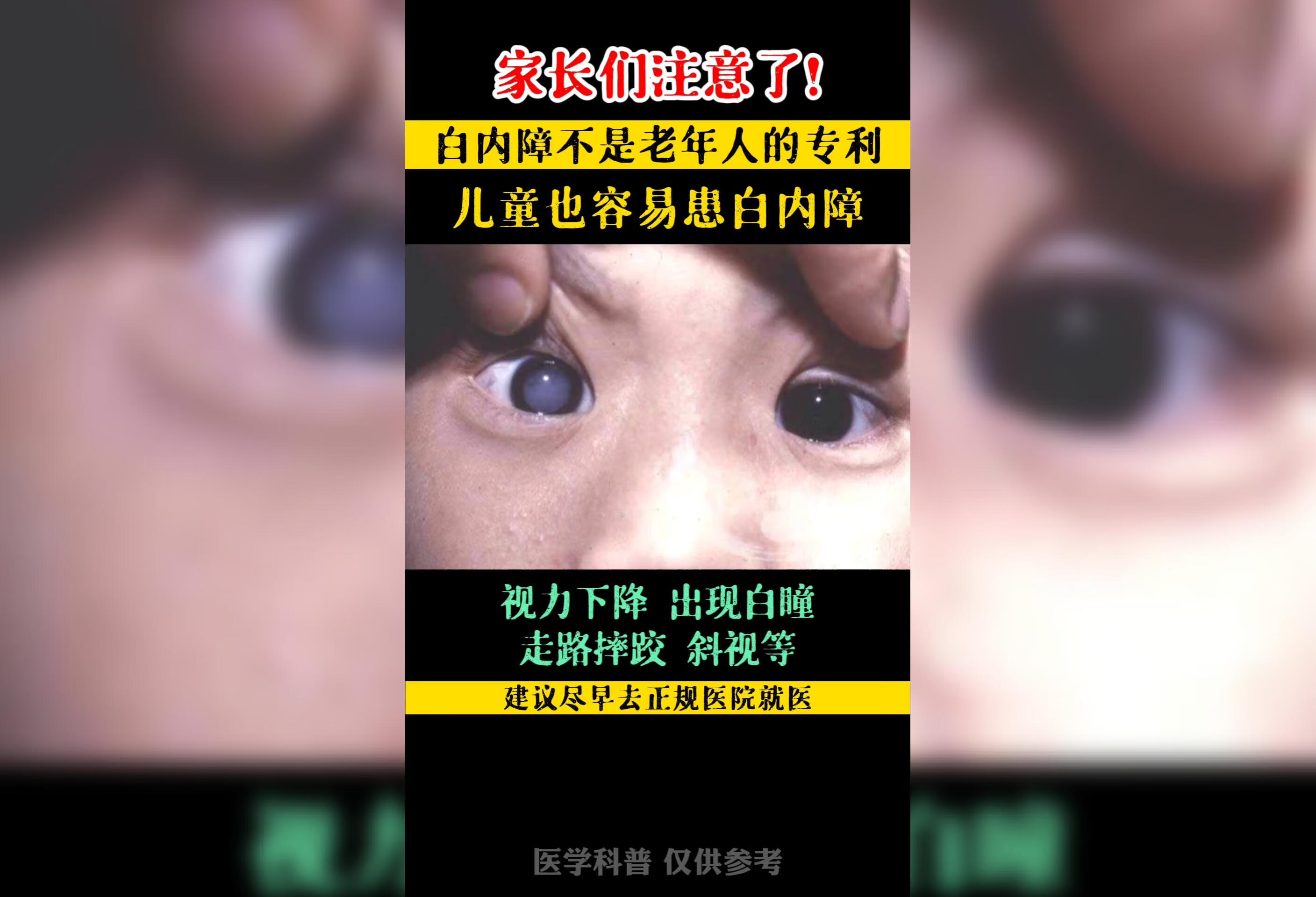 白内障 不是老人的专利，小孩也会得白内障