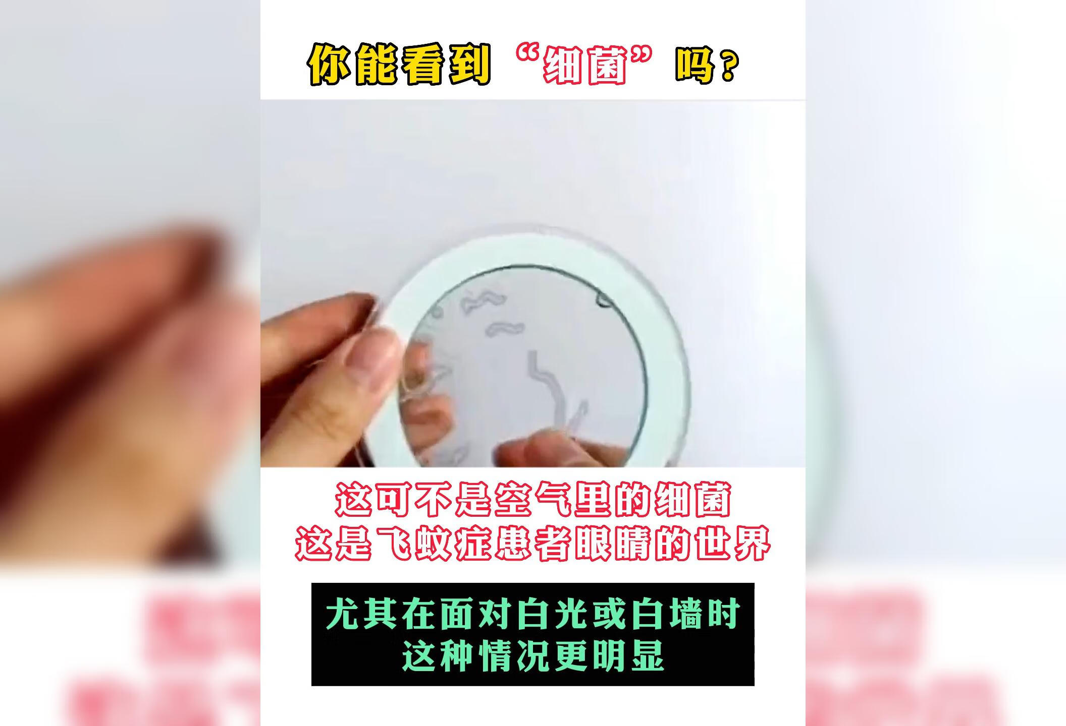 飞蚊症患者的眼睛世界