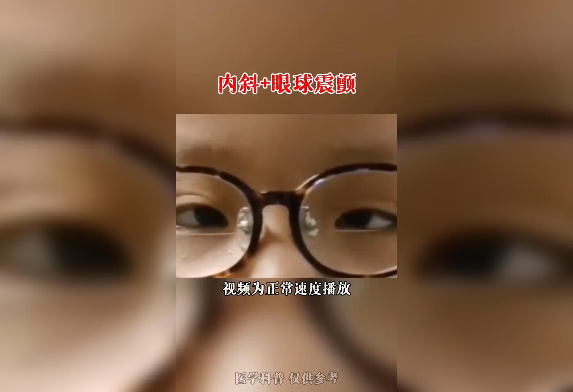 眼球左右或上下摆动称为眼震