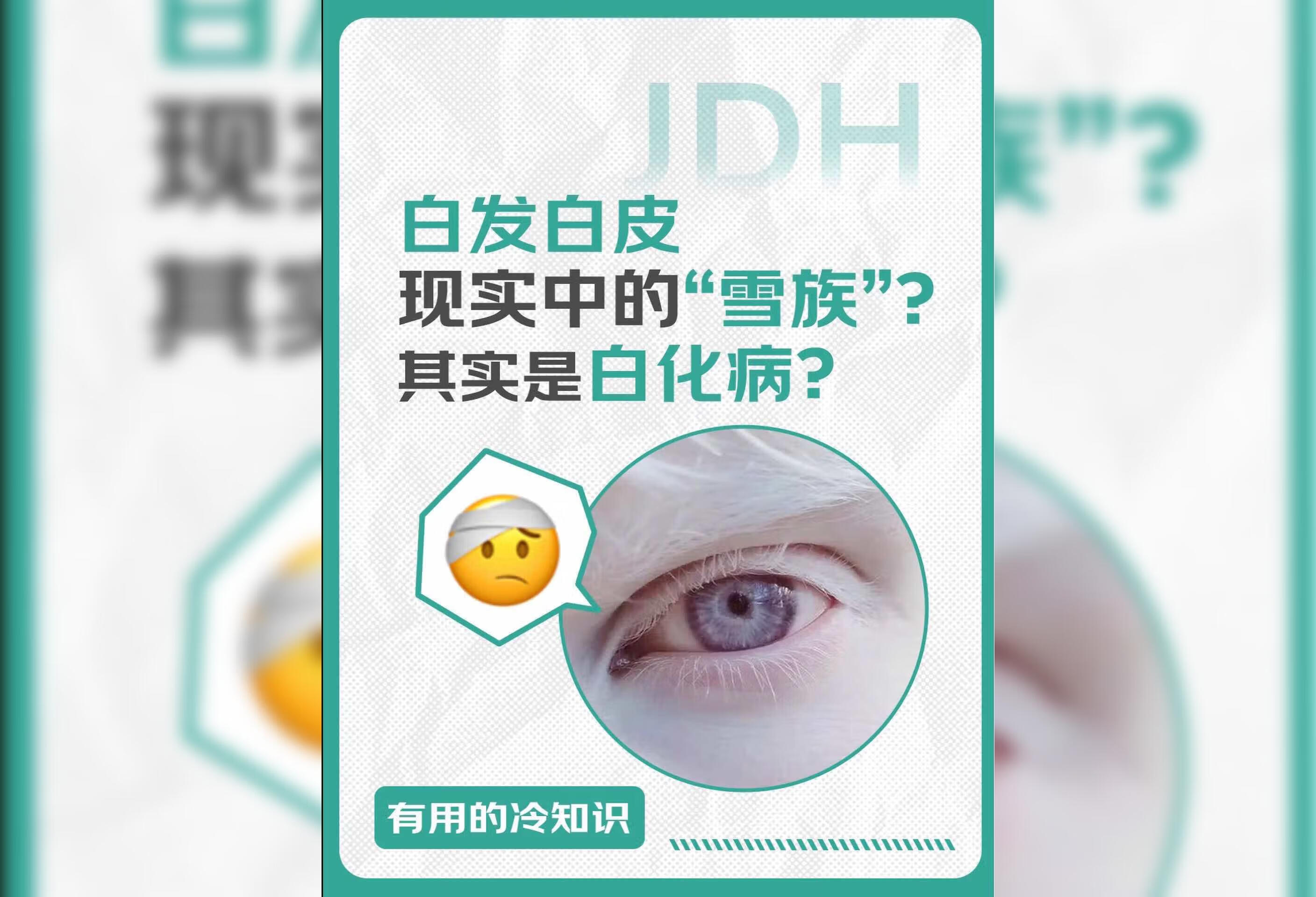 白发白肤？是什么让他们变成月亮的孩子？