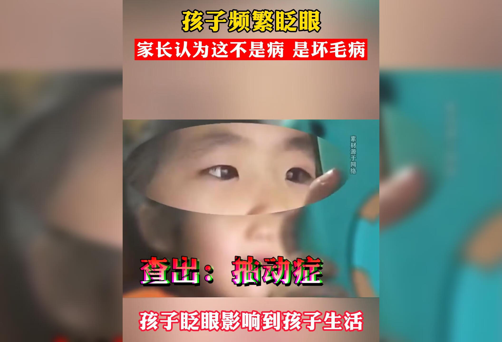 孩子频繁眨眼，可能是抽动症