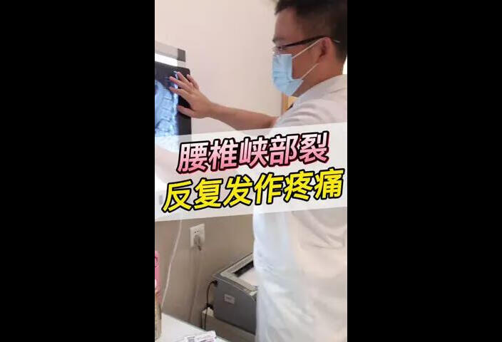 腰椎峡部裂反反复复发作腰部疼