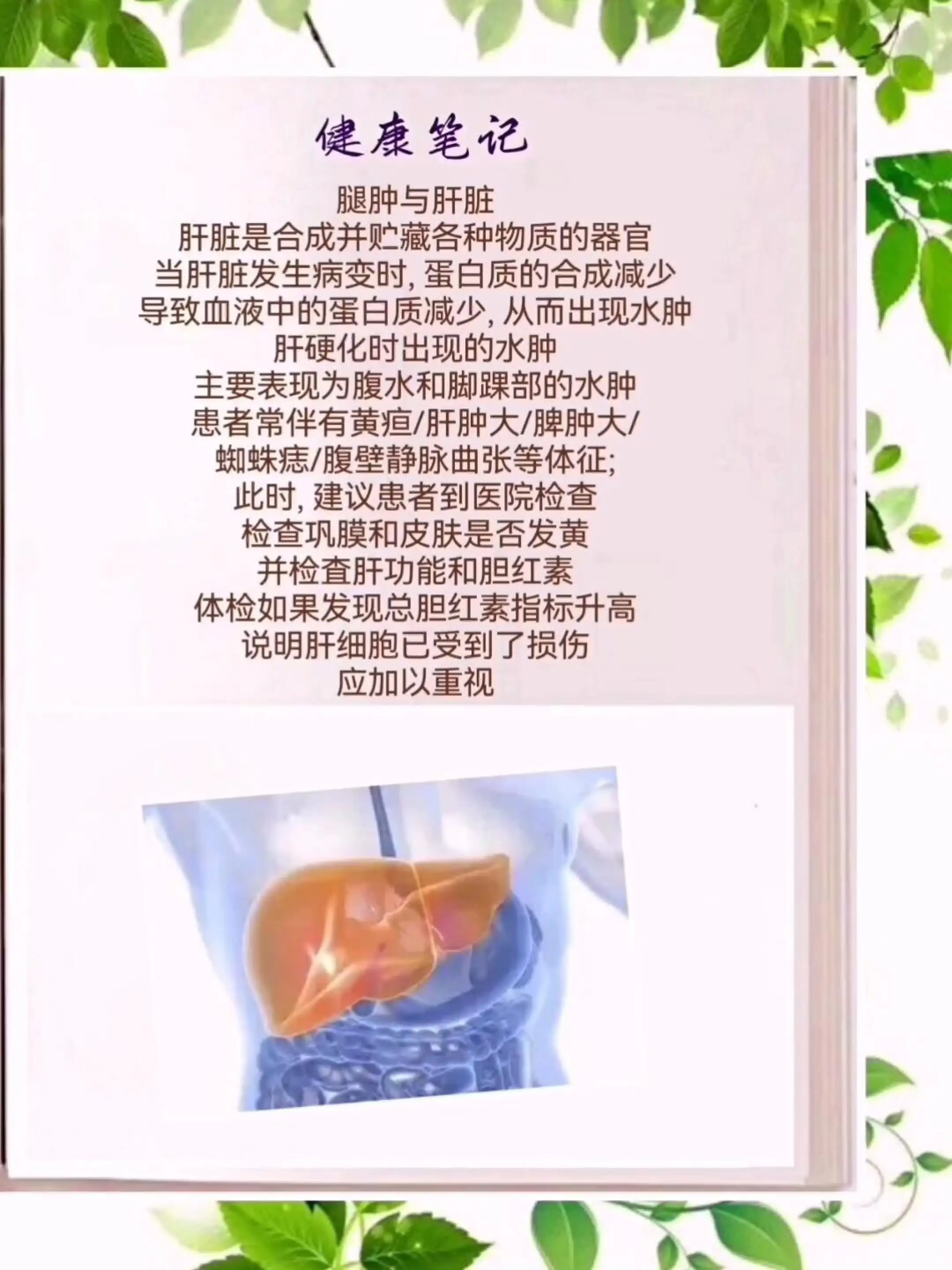 肝源性水肿的特点图片图片