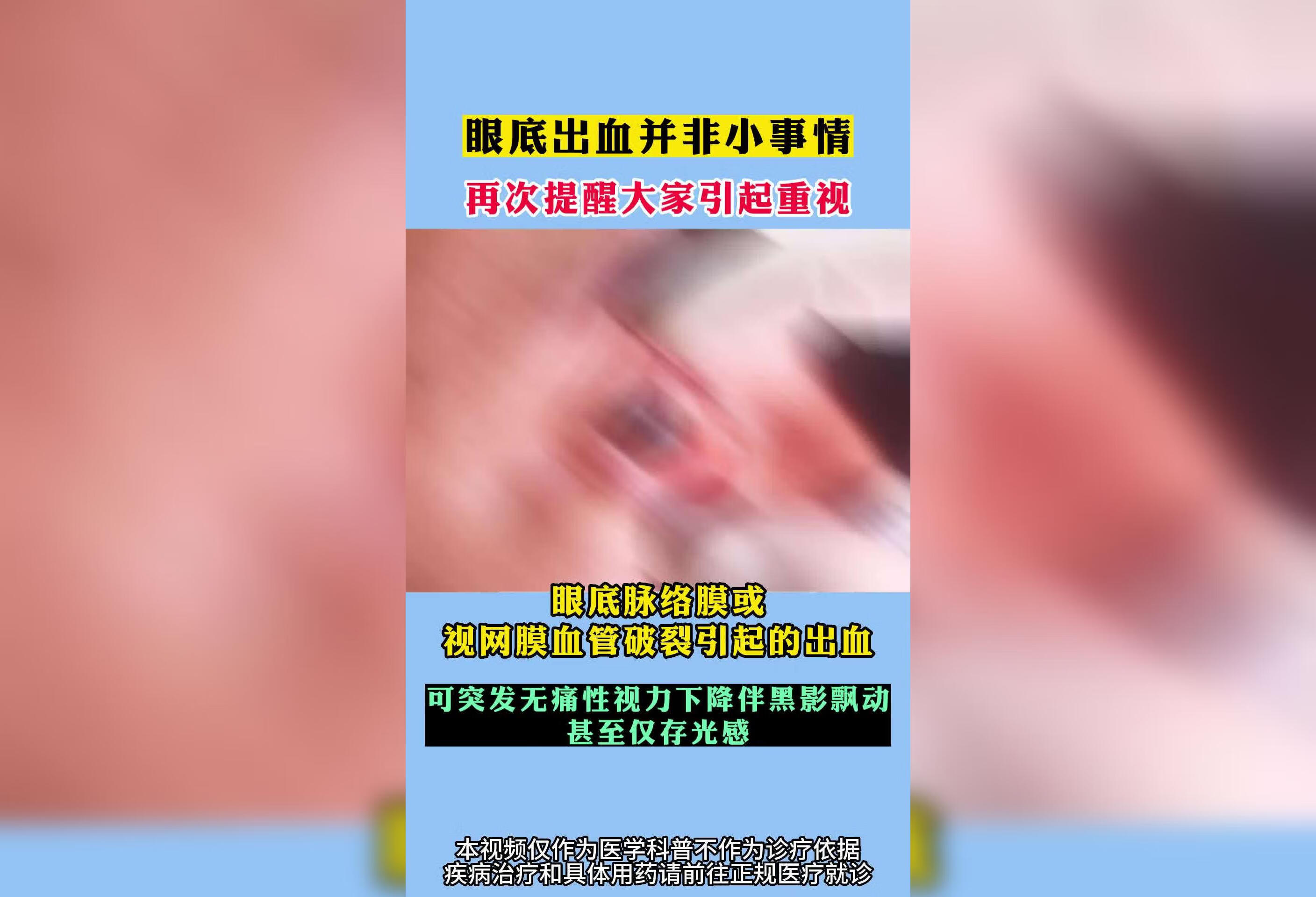 眼底出血并非小事情，需引起重视