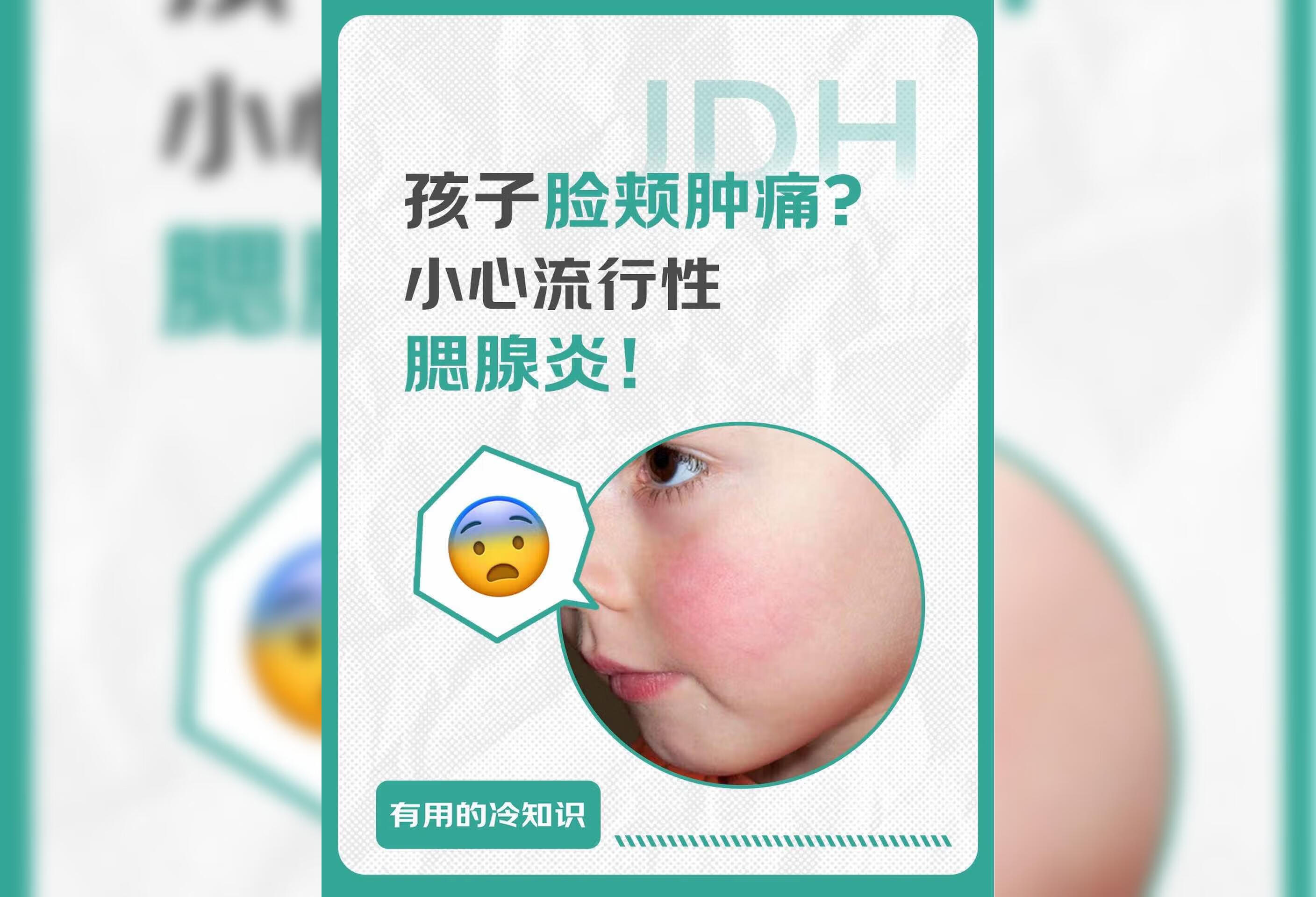 孩子突然两腮肿痛浑身乏力？警惕流行性腮腺炎